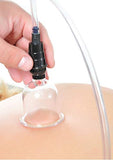 Ff Beginners 6Pc Cupping Set