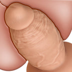 3.8 ' ' Diameter Huge Thick Anal Dildo, 7.5 Inch Huge Silicone Girth Dildo Butt Plugs with Strong Suction Cup & No Balls for Dee