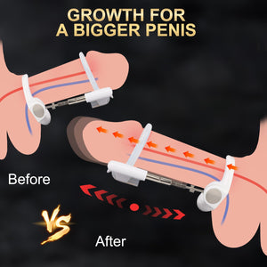 Penis Extender Stretcher Kit, Penis Pump Sex Toys for Men, Penis Stretcher Device for Men, Penis Enlargement Adjustable Stretchi