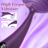 Adult Sex Toys for Women, High Frequency Clitoral G Spot Vibrator with 10 Powerful Vibrating Modes, Precision Targeted Clit Nipp