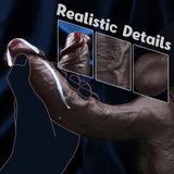 Sexgene 10.43 Inch Realistic Big Black Dildo Sex Toys, Feels Real Skin Huge Thick Dildo with Strong Suction Cup for Hands-Free,