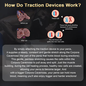 Penis Extender Stretcher Kit, Penis Pump Sex Toys for Men, Penis Stretcher Device for Men, Penis Enlargement Adjustable Stretchi