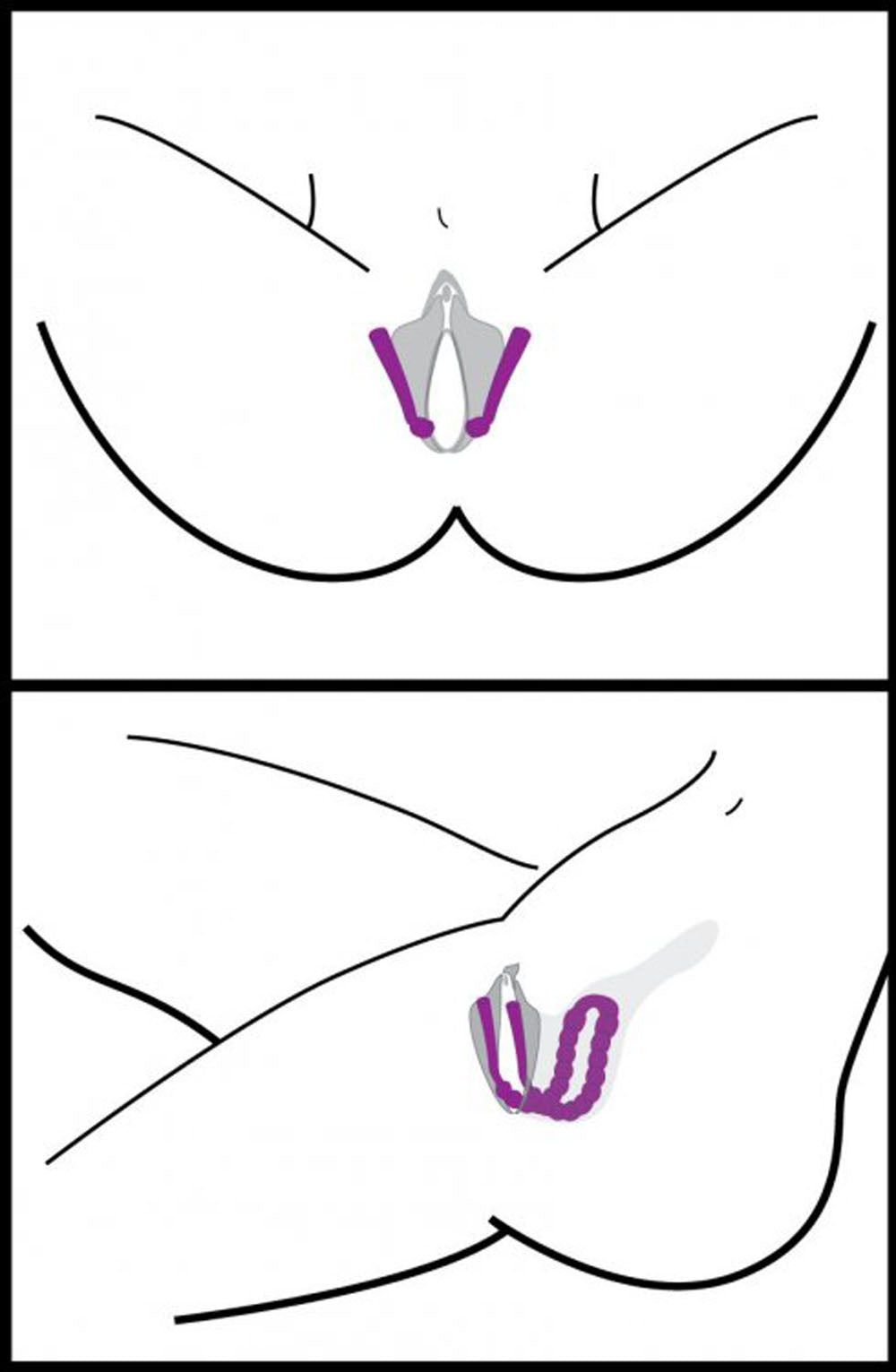 Frisky Oral Enhancing Hands-Free Labia Spreader